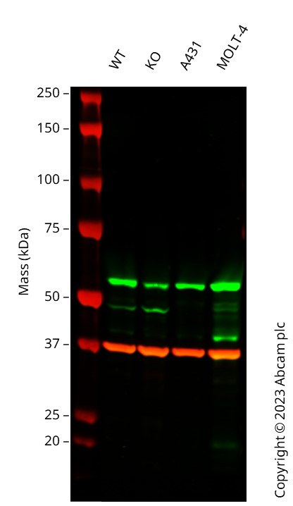 Western blot - Human CHEK1 heterozygous knockout A549 cell line (AB276102)