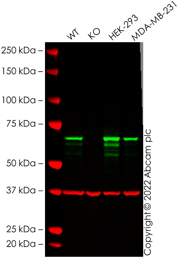 Western blot - Human CHEK2 (Chk2) knockout A549 cell line (AB276098), expandable thumbnail