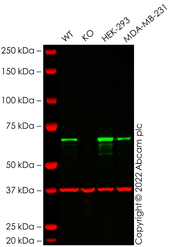 Western blot - Human CHEK2 (Chk2) knockout A549 cell line (AB276098), expandable thumbnail
