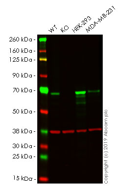 Western blot - Human CHEK2 (Chk2) knockout HeLa cell lysate (AB257104), expandable thumbnail