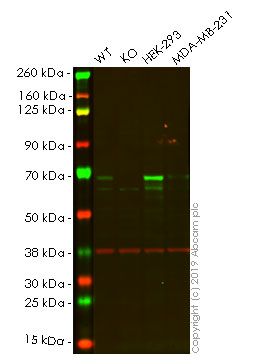 Western blot - Human CHEK2 (Chk2) knockout HeLa cell lysate (AB257104), expandable thumbnail
