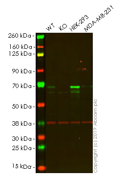 Western blot - Human CHEK2 (Chk2) knockout HeLa cell lysate (AB257104)
