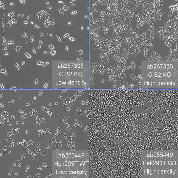 Human CIB2 knockout HEK-293T cell line