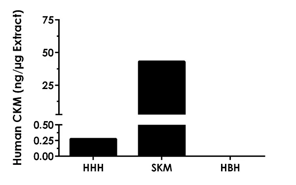 Sandwich ELISA - Human CKM ELISA Kit, Chemiluminescent (AB326894)