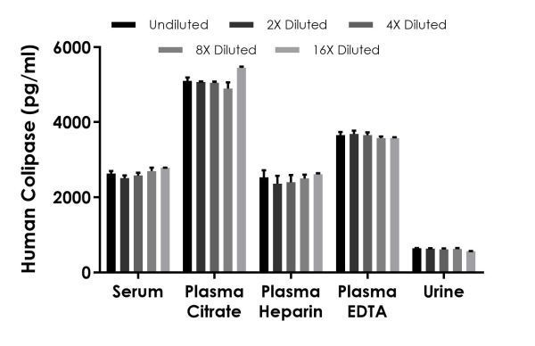 Sandwich ELISA - Human Colipase ELISA Kit (AB230937)