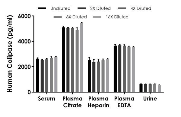Sandwich ELISA - Human Colipase ELISA Kit (AB230937)
