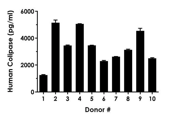 Sandwich ELISA - Human Colipase ELISA Kit (AB230937)