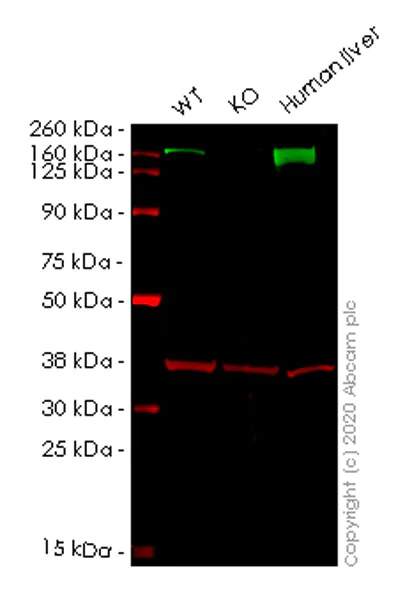 Western blot - Human CPS1 knockout HeLa cell lysate (AB257121)