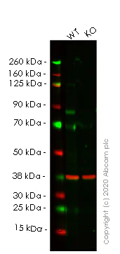 Western blot - Human CPT1A knockout HEK-293T cell line (AB266319)