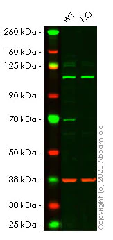 Western blot - Human CPT2 knockout HeLa cell lysate (AB257180)