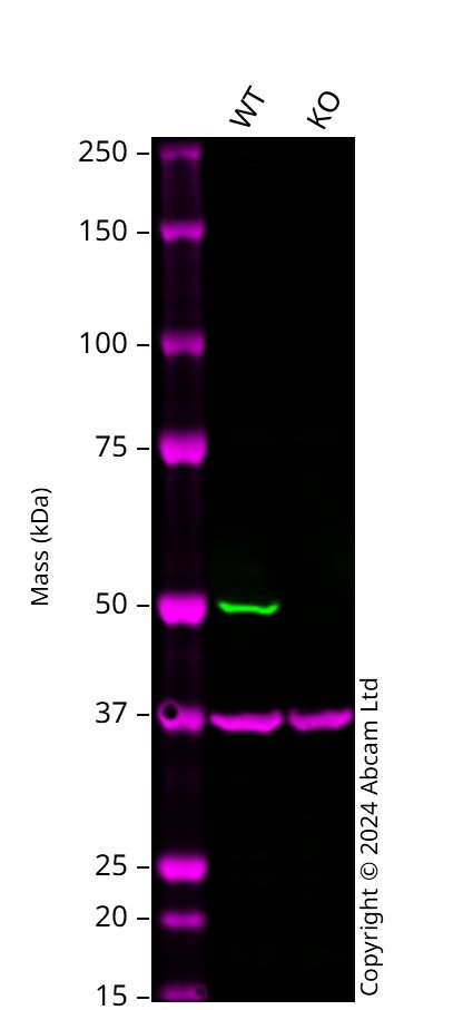 Western blot - Human CSK knockout A549  cell line (AB300902), expandable thumbnail