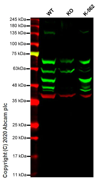 Western blot - Human CSNK1D (Casein Kinase 1 delta) knockout HeLa cell line (AB264667)