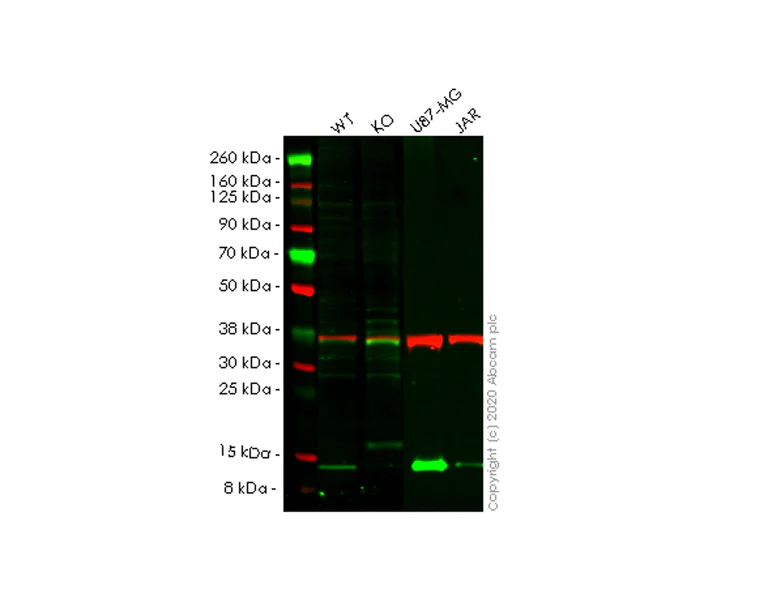 Western blot - Human CSTB (Cystatin-B) knockout HEK-293T cell line (AB266321)