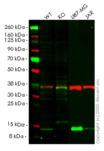 Western blot - Human CSTB (Cystatin-B) knockout HEK-293T cell lysate (AB257905)