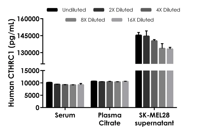 Sandwich ELISA - Human CTHRC1 ELISA Kit, Chemiluminescent (AB325998)