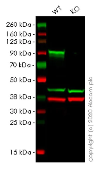 Western blot - Human CTNNB1 (beta Catenin) knockout HeLa cell line (AB255352)