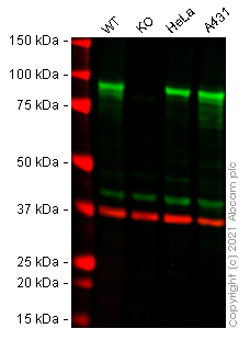 Western blot - Human CTNNB1 (beta Catenin) knockout Hep G2 cell line (AB277911)