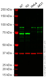 Human CTNNB1 (beta Catenin) knockout Hep G2 cell line