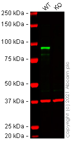 Western blot - Human CTNNB1 knockout HCT116 cell line (AB273712), expandable thumbnail