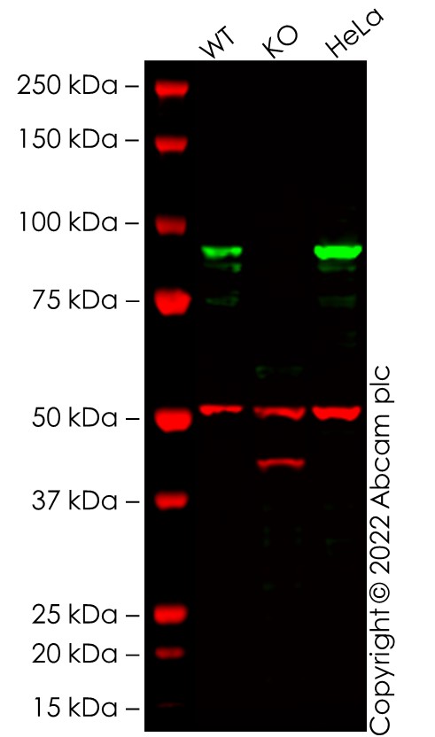 Western blot - Human CTNNB1 knockout MCF7 cell line (AB286762), expandable thumbnail