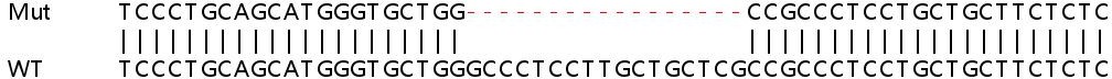 Sanger Sequencing - Human CTSC (Cathepsin C) knockout HeLa cell line (AB265822), expandable thumbnail