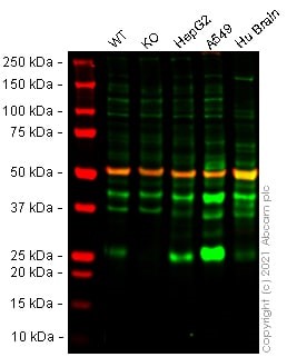 Western blot - Human CTSL (Cathepsin L/MEP) knockout HEK-293T cell lysate (AB257213), expandable thumbnail