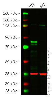 Western blot - Human CTTN (Cortactin) knockout HEK-293T cell lysate (AB257147)