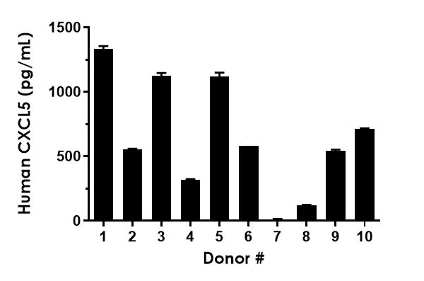 Sandwich ELISA - Human CXCL5 ELISA Kit (AB212163)