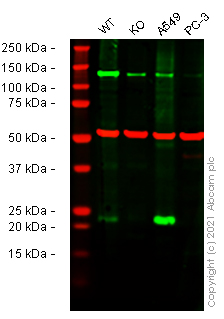 Human CYBA (Cytochrome b245 Light Chain/p22-phox) knockout HEK-293T cell line