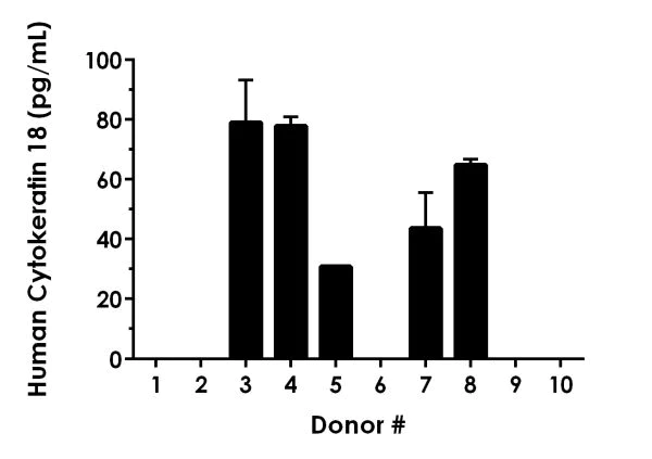 Sandwich ELISA - Human Cytokeratin 18 ELISA Kit (AB227896)