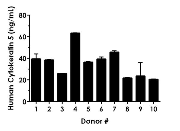 Sandwich ELISA - Human Cytokeratin 5 ELISA Kit (AB226896)