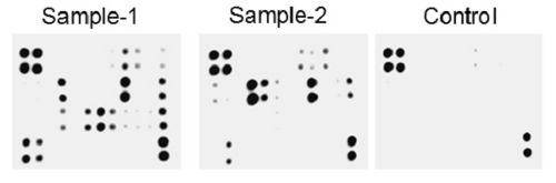 Multiplex Protein Detection - Human Cytokine Antibody Array - Membrane (174 Targets) (AB193657), expandable thumbnail