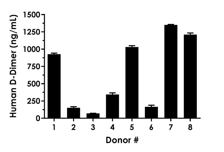 Sandwich ELISA - Human D-Dimer, Fluorescent ELISA Kit (AB315311)