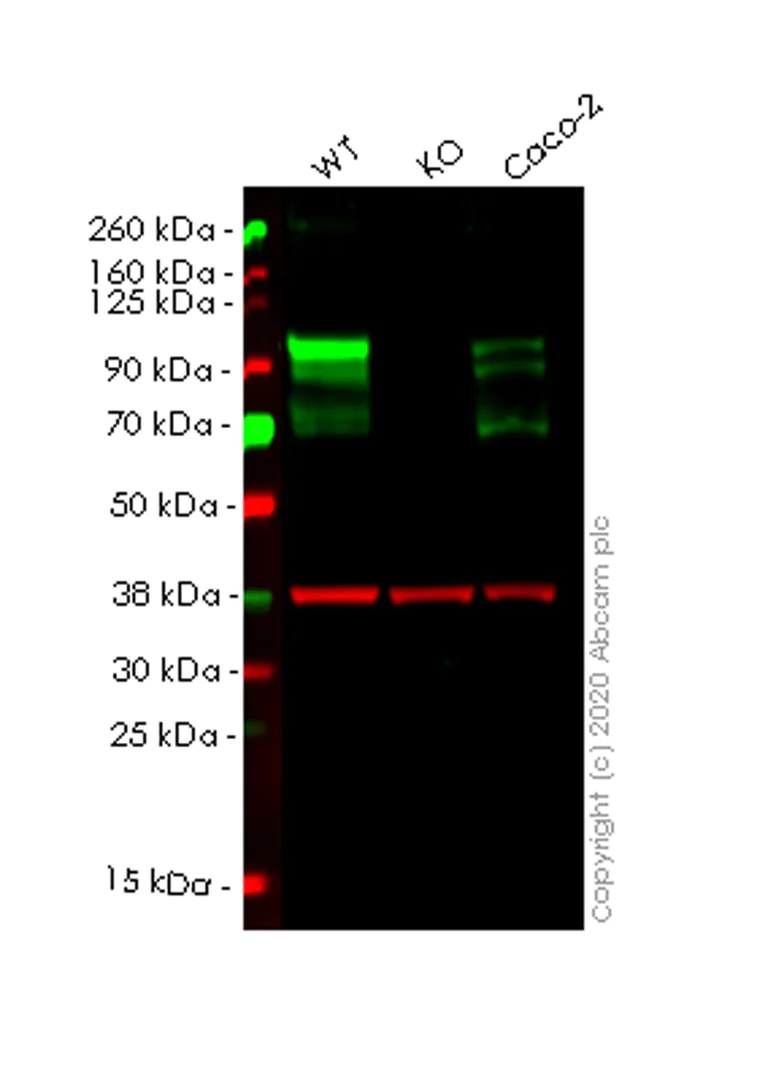 Western blot - Human DAB2 knockout HeLa cell line (AB265731)