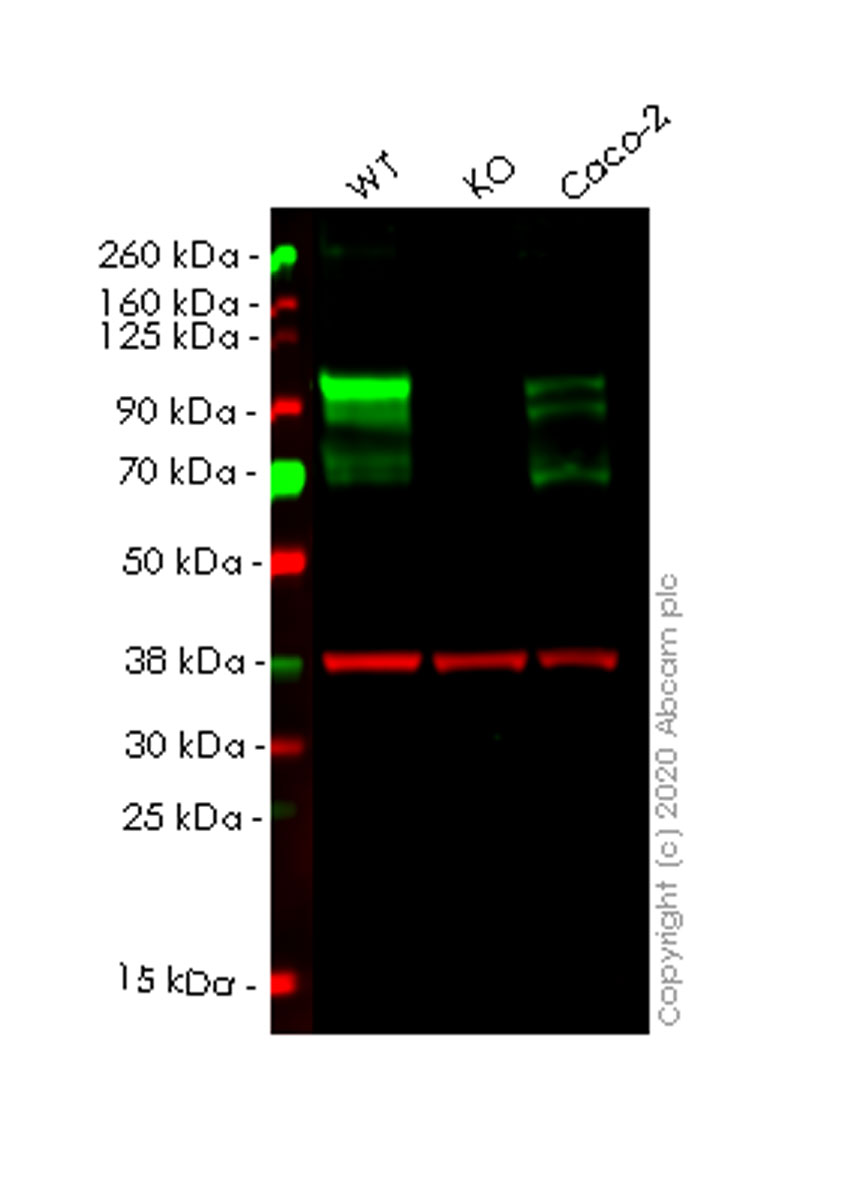 Western blot - Human DAB2 knockout HeLa cell lysate (AB257910)