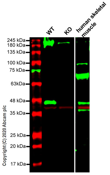 Western blot - Human DAG1 knockout HEK-293T cell line (AB266263)