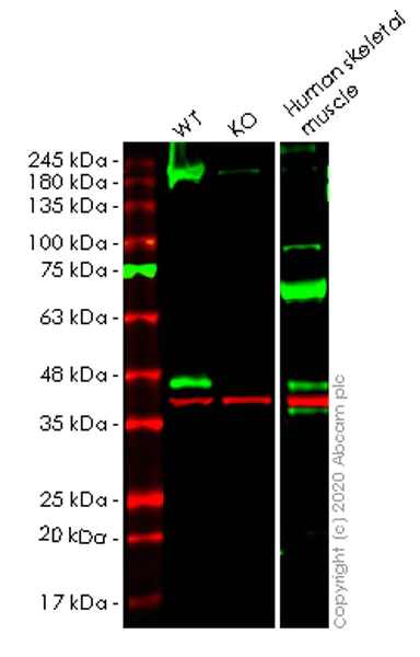 Western blot - Human DAG1 knockout HEK-293T cell lysate (AB257192)