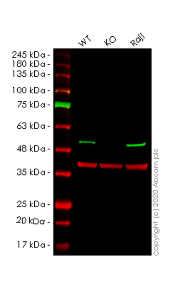 Western blot - Human DDB2 knockout HeLa cell lysate (AB257177)