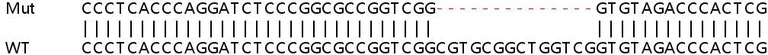 Sanger Sequencing - Human DEGS1 (MLD) knockout HEK-293T cell line (AB266481)