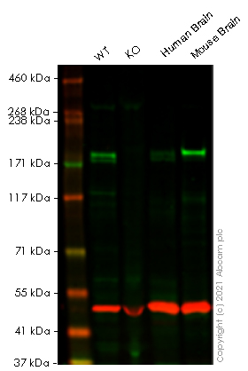 Western blot - Human DEPDC5 knockout A549 cell line (AB266906)