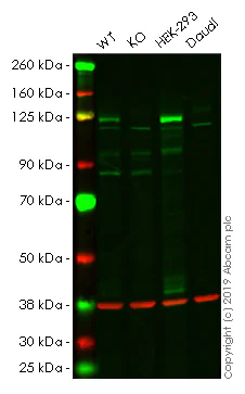 Western blot - Human DNMT3A knockout HeLa cell line (AB261793)