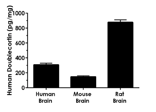 Sandwich ELISA - Human Doublecortin ELISA Kit (AB218267)