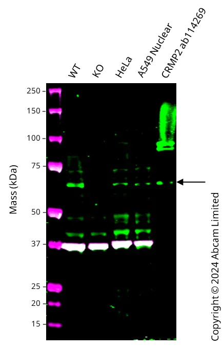 Western blot - Human DPYSL2 knockout A549 cell line (AB300921)