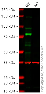 Western blot - Human DSG2 (Desmoglein 2) knockout HeLa cell lysate (AB257158)