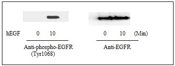 Western blot - Human EGFR ELISA Kit (pY1068) (AB126438), expandable thumbnail