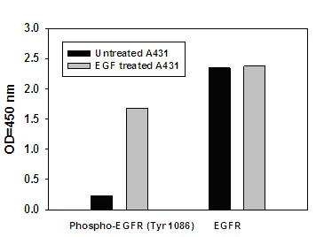Sandwich ELISA - Human EGFR ELISA Kit (pY1086) (AB126440)