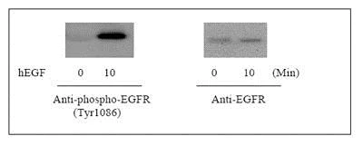 Western blot - Human EGFR ELISA Kit (pY1086) (AB126440)