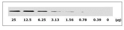 Western blot - Human EGFR (pY1086) + total EGFR ELISA Kit (AB126441)
