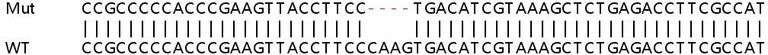 Sanger Sequencing - Human EMC2 (TTC35) knockout HeLa cell line (AB265234)
