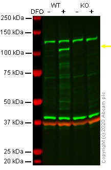 Western blot - Human EPAS1 (HIF-2-alpha) knockout A549 cell line (AB259774)